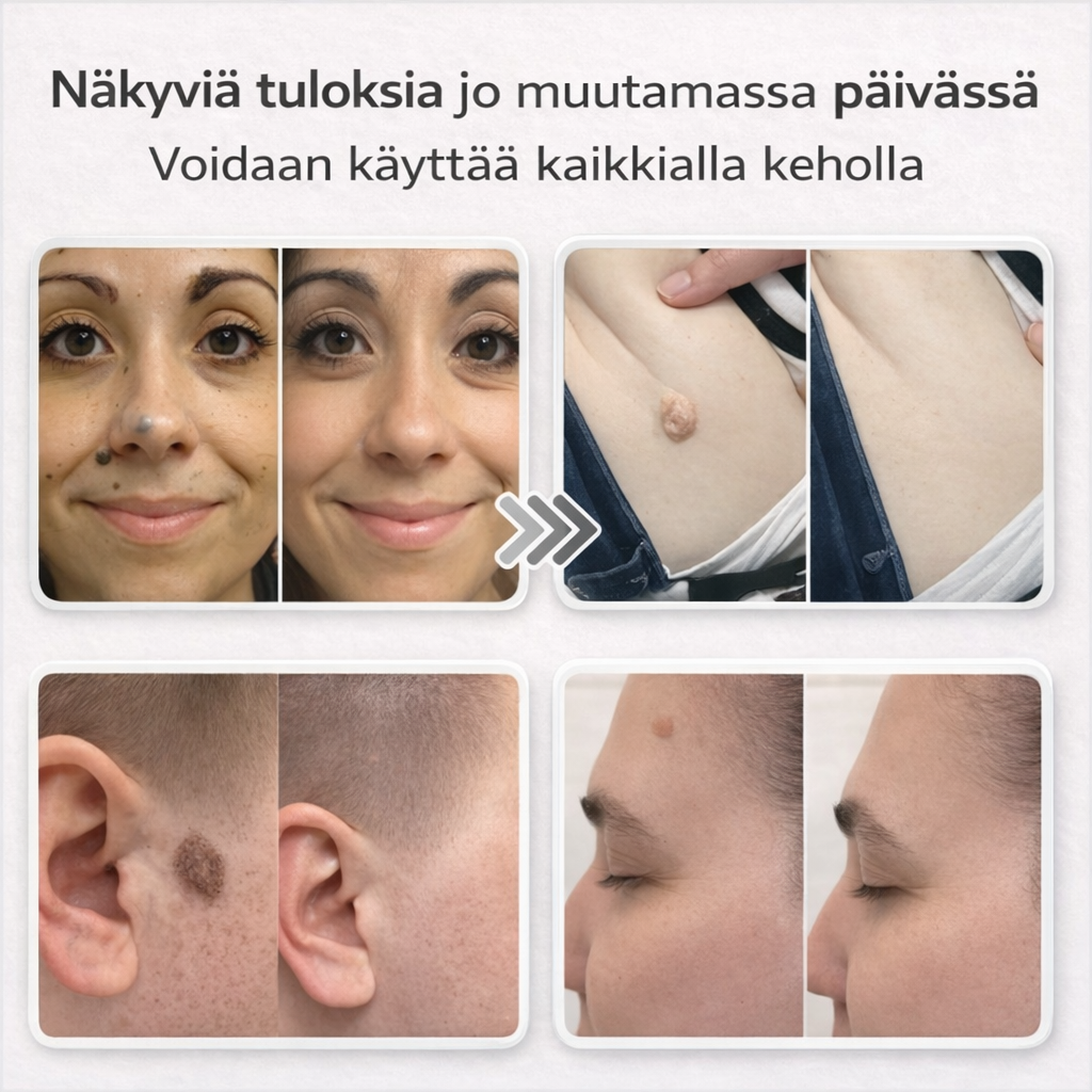 Lovera Care – Iholaastarit