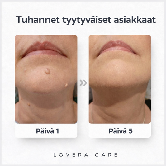 Lovera Care – Iholaastarit